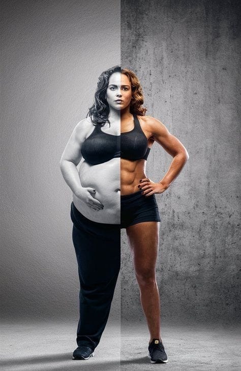 Before and after results of liposuction in Bodrum for body contouring