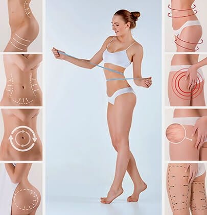 liposuction
