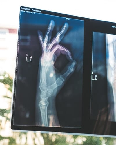 Orthopedics